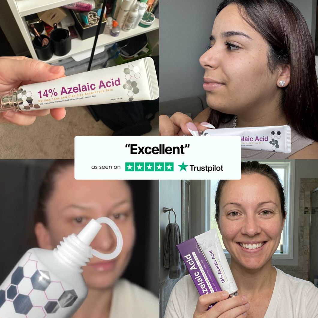 Lelixa Azelaic Acid 14% Cream