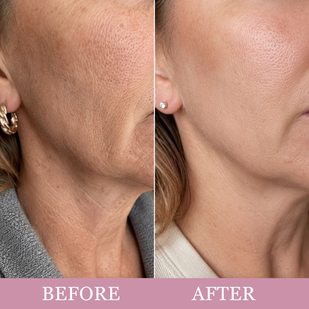 Collagen Gua Sha Lifting Cream