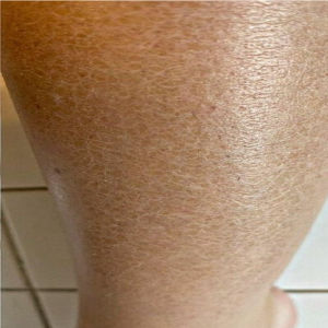 Lelixa Exfoliating Towel