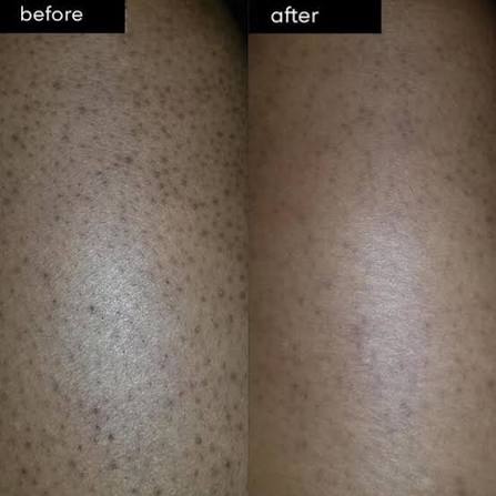 Glycolic Body Stick