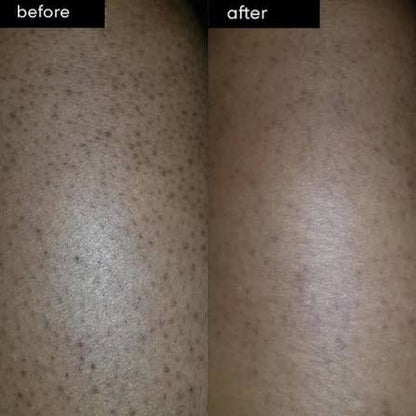 Glycolic Body Stick